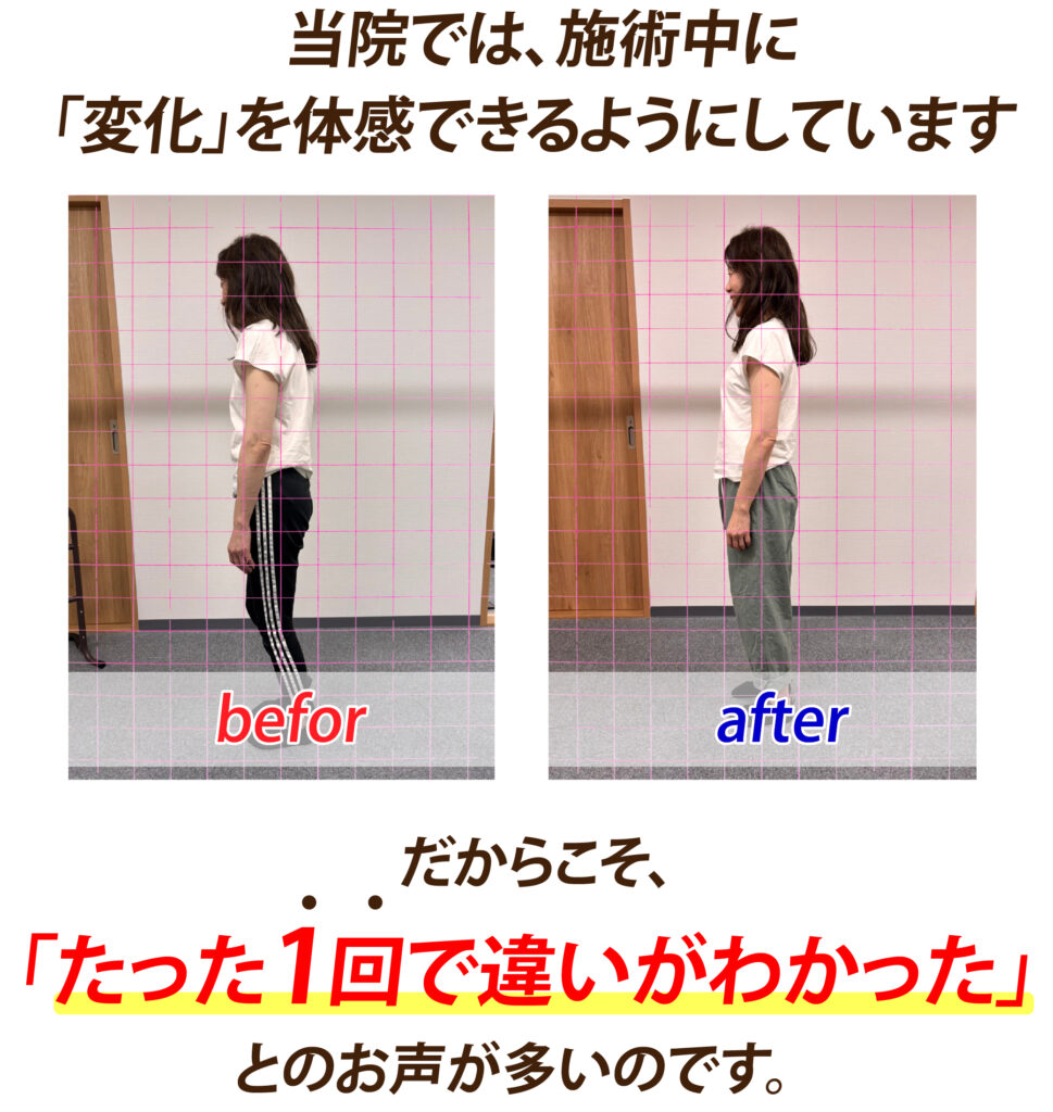 画像に alt 属性が指定されていません。ファイル名: hiza02_bn2-969x1024.jpg
